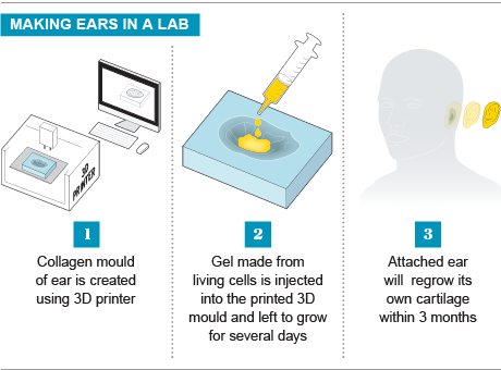 ایجاد یک گوش مصنوعی با استفاده از چاپ 3D و ژل های زندگی سلول